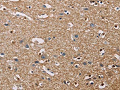 PIP4K2A Antibody