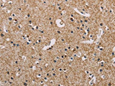 PIP4K2A Antibody