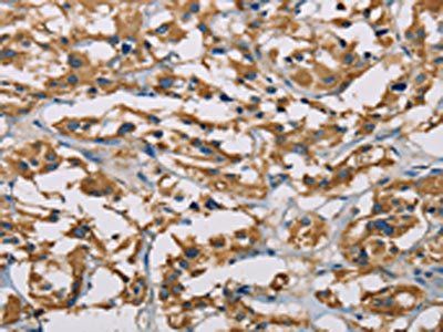 PIP4K2A Antibody