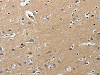 PIP5K1C Antibody