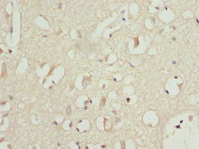 PITRM1 Antibody