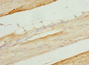 PITRM1 Antibody