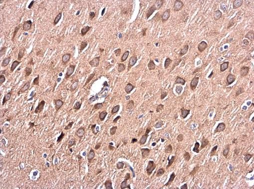 PKC alpha Rabbit Polyclonal Antibody
