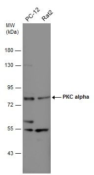 PKC alpha Rabbit Polyclonal Antibody