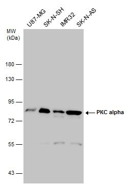 PKC alpha Rabbit Polyclonal Antibody