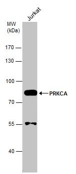 PKC alpha Rabbit Polyclonal Antibody