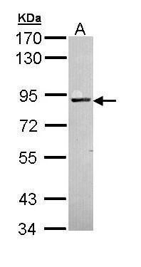 PKC alpha Rabbit Polyclonal Antibody