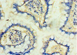 PKD2L1 Antibody