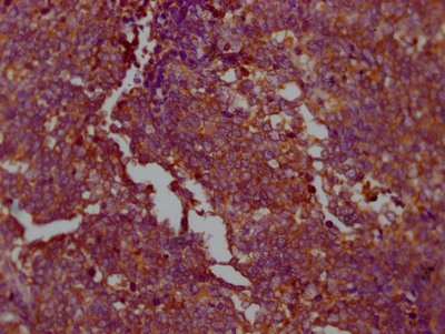 PKM Antibody