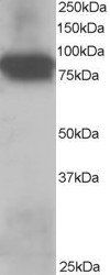 Plakoglobin/Gamma-catenin Antibody