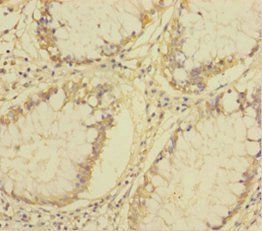PLA2G7 Antibody