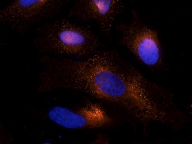 PLK4 Rabbit Polyclonal Antibody