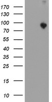 PMVK Antibody
