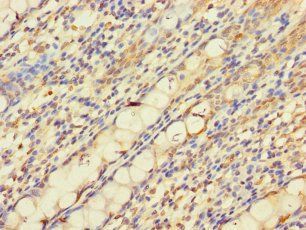 PNPLA2 Antibody