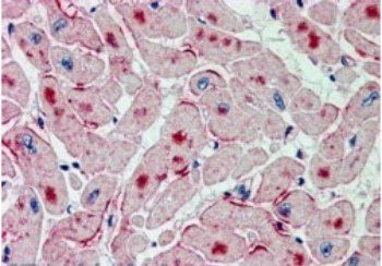 ATGL/Desnutrin Antibody