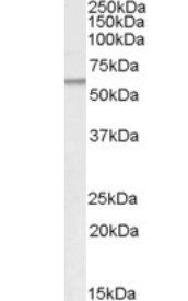 ATGL/Desnutrin Antibody