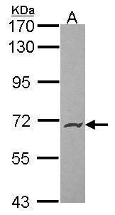 HMW Kininogen Rabbit Polyclonal Antibody
