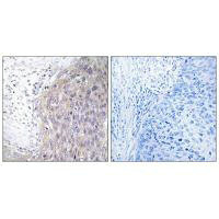 POLG2 Antibody