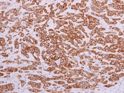 PON2 Rabbit Polyclonal Antibody