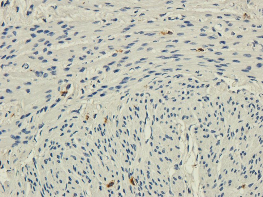 POSTN Rabbit Polyclonal Antibody