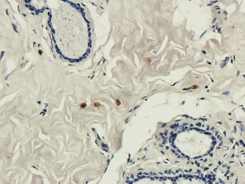 POSTN Rabbit Polyclonal Antibody