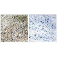 POTEG/POTEH Antibody