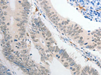 POU2F1 Antibody
