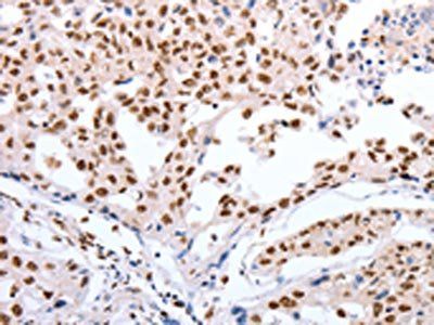 POU3F1 Antibody