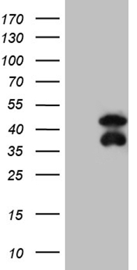 POU4F3 Antibody