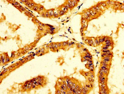 PPA1 Antibody