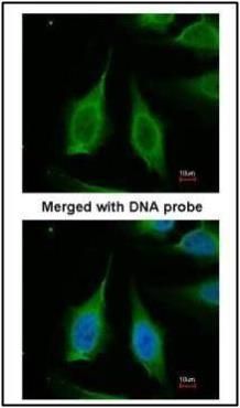 PPA1 Rabbit Polyclonal Antibody