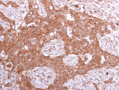 PPA1 Rabbit Polyclonal Antibody