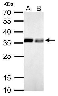 PPA1 Rabbit Polyclonal Antibody