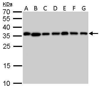 PPA1 Rabbit Polyclonal Antibody