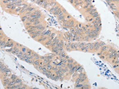 PLPP1 Antibody