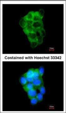 PPFIBP2 Rabbit Polyclonal Antibody
