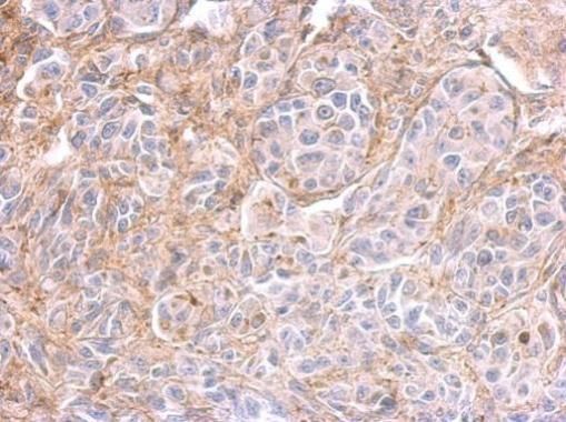 PPFIBP2 Rabbit Polyclonal Antibody