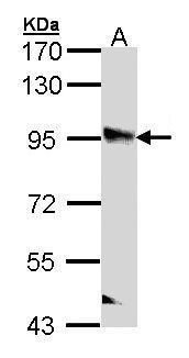 PPFIBP2 Rabbit Polyclonal Antibody