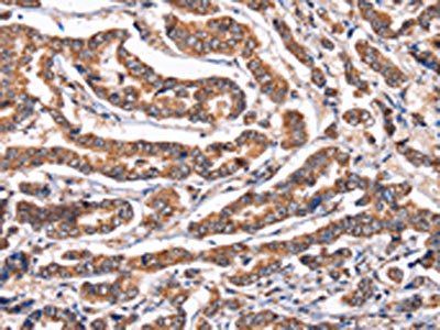PPIF Antibody