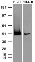 PPM1D Antibody