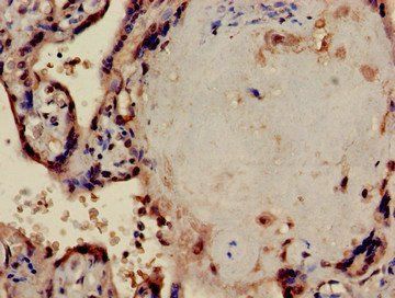 PPP1CA Antibody