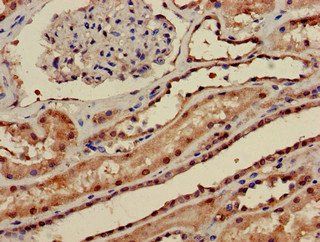 PPP1CA Antibody