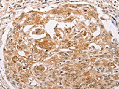 PPP1CB Antibody