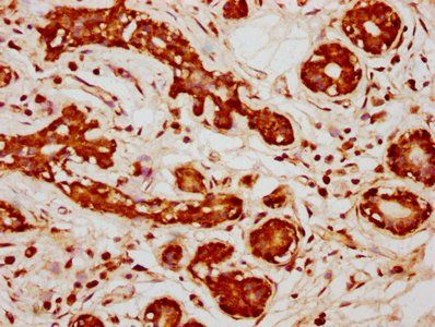 PPP2R1B Antibody