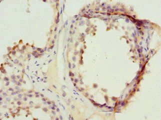 PPP2R1B Antibody