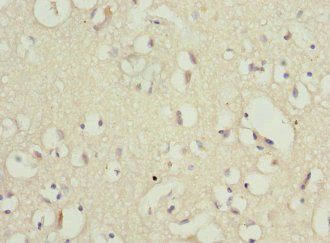 PPP2R1B Antibody