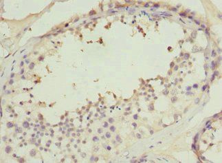 PPP2R1B Antibody
