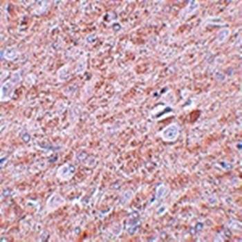 PRDM16 Rabbit Polyclonal Antibody