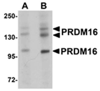 PRDM16 Rabbit Polyclonal Antibody