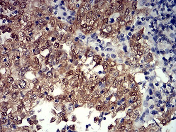 PRDM4 Antibody